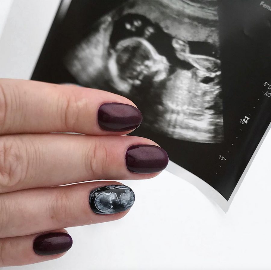 jak dbać o paznokcie w ciąży